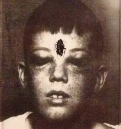 Suma : Global Lobotomy Process Live in Moscow